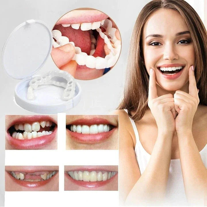 Instant Fit Veneers for Upper and Lower Teeth for a Natural Smile