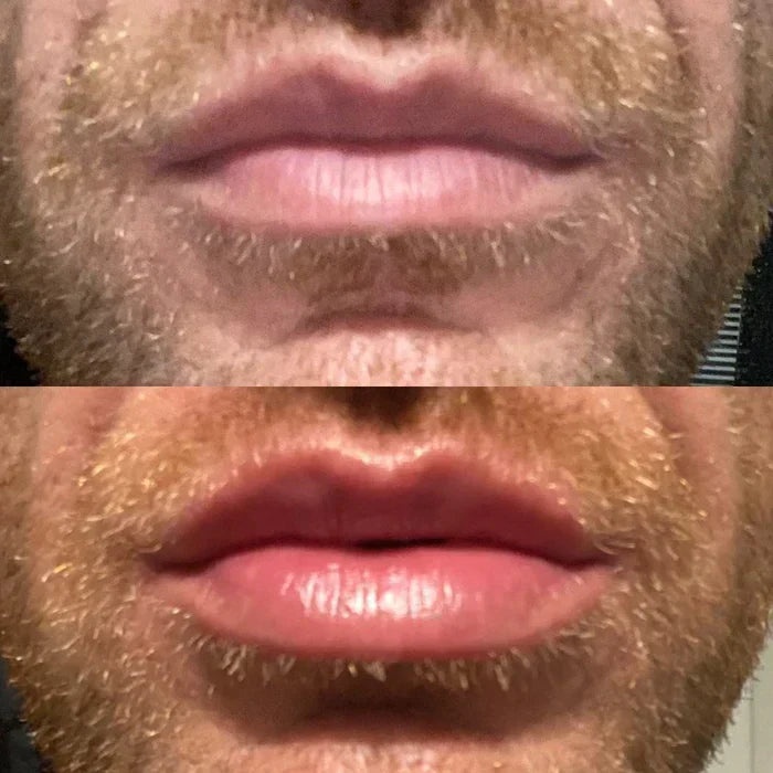 Instant Lip Plumping Serum