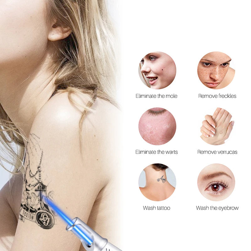 Laser Pen for Removing Tattoos, Moles, and Freckles
