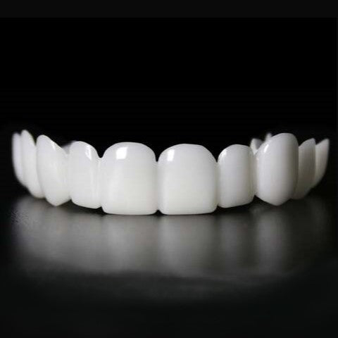 Instant Fit Veneers for Upper and Lower Teeth for a Natural Smile