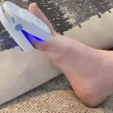 Home Laser Treatment Device for Toenail Fungus