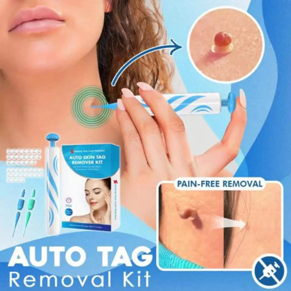 Skin Tag Removal Kit - Easily Remove Skin Tags