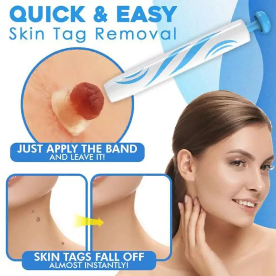 Skin Tag Removal Kit - Easily Remove Skin Tags