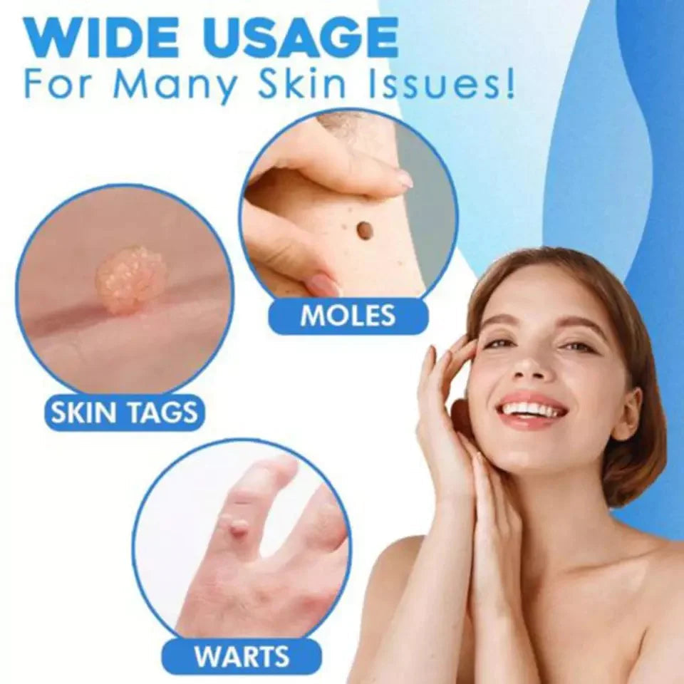 Skin Tag Removal Kit - Easily Remove Skin Tags