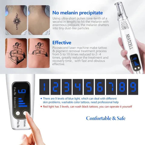 Laser Pen for Removing Tattoos, Moles, and Freckles