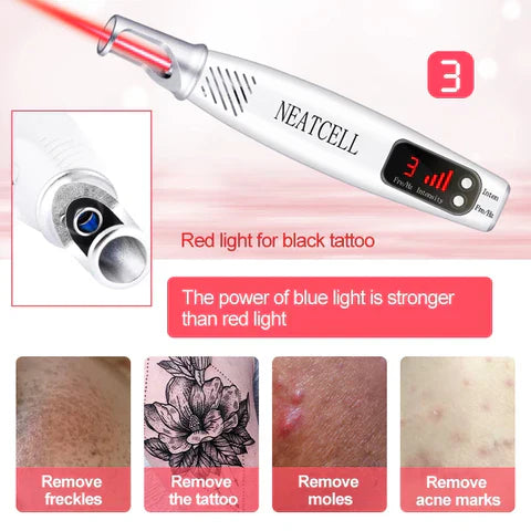 Laser Pen for Removing Tattoos, Moles, and Freckles