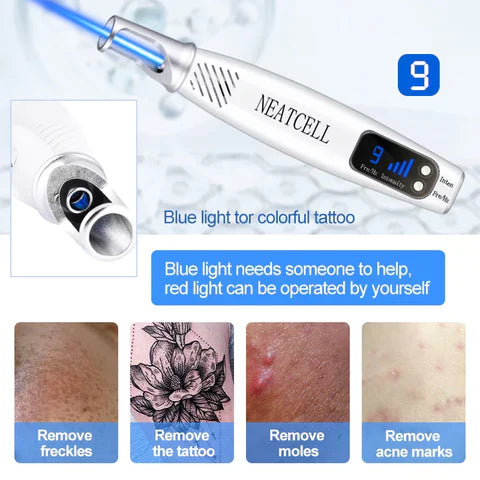Laser Pen for Removing Tattoos, Moles, and Freckles