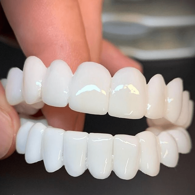 White Dental Lens Prosthesis