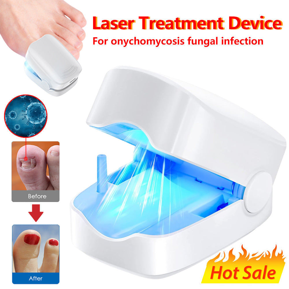 Home Laser Treatment Device for Toenail Fungus