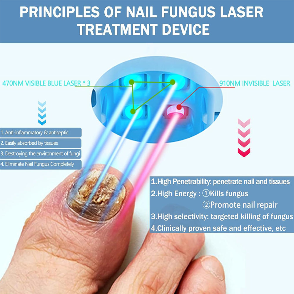 Home Laser Treatment Device for Toenail Fungus