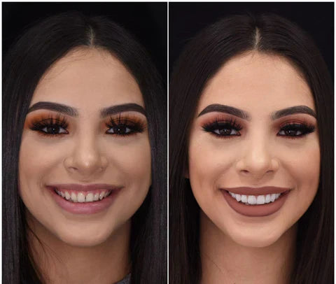 Instant Fit Veneers for Upper and Lower Teeth for a Natural Smile
