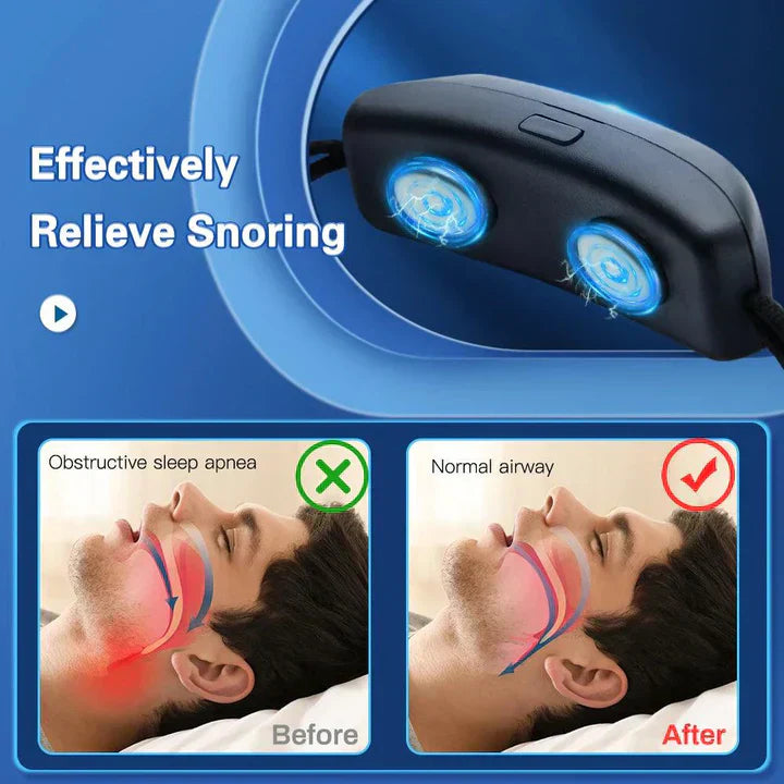 Rechargeable Portable Smart Anti-Snoring Device with EMS Pulse for Comfortable Sleep and Sleep Apnea Relief